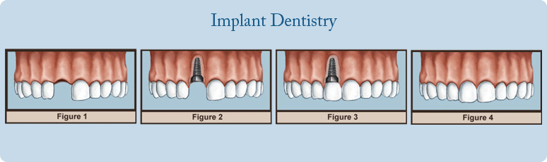 East Delhi Dental Clinic